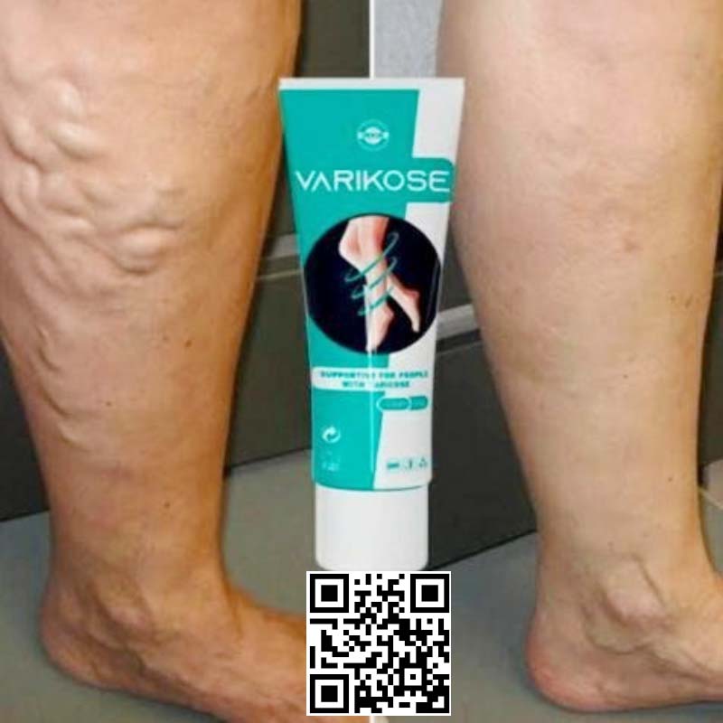 Tự tin bước đi mỗi ngày với Varikose Premium chăm sóc chân và da